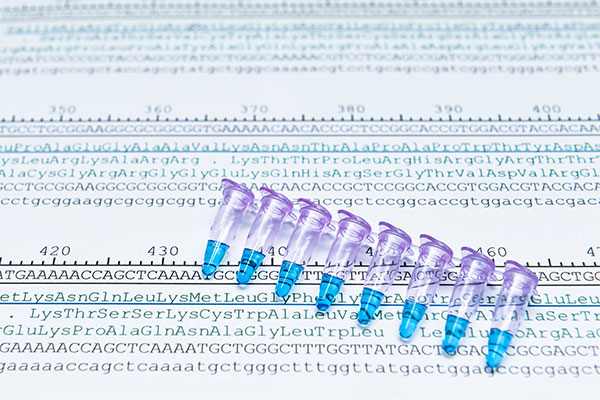 Protein sequencing by analysis of codon of DNA sequence