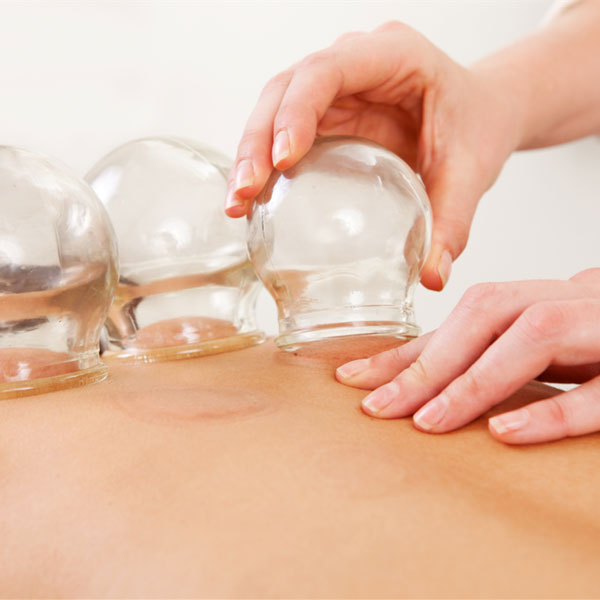 Cupping relaxation method performed on person's back